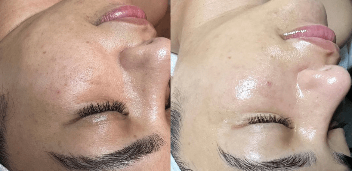 Treatment room at Aura